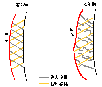 老化現象であるしわの模式図